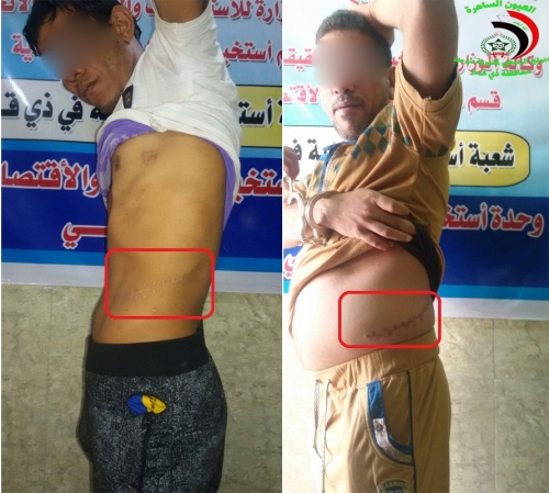 القبض على متهم بالمتاجرة بالأعضاء البشرية شمال ذي قار